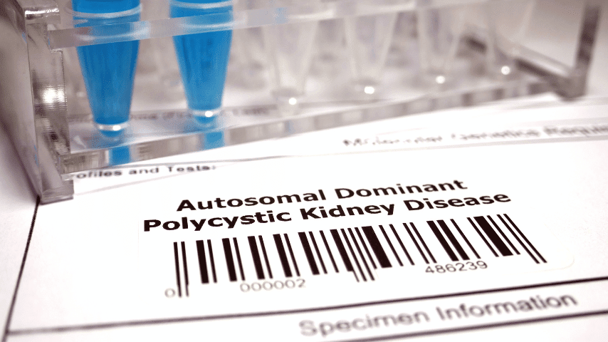 Panduan Skrining dan Pencegahan PKD pada Kucing Persia: Yang Harus Diketahui Pemilik